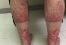 HT10. These are the consequences of sleeping with the…