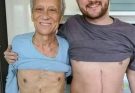 Son who donated part of his liver to his father unfortunately ends up fa…